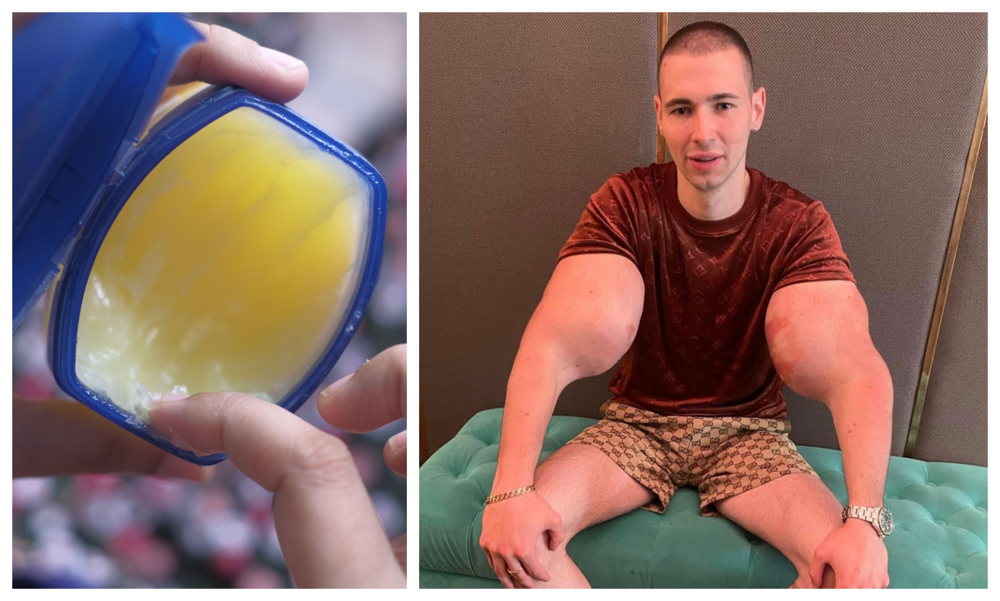 Kirill Tereshin, 25, har flera liter vaselin i sina armar.